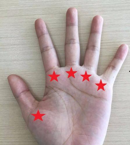 「鼠标手症状」鼠标手症状及治疗方法右手无名指跟手掌连接处长老茧